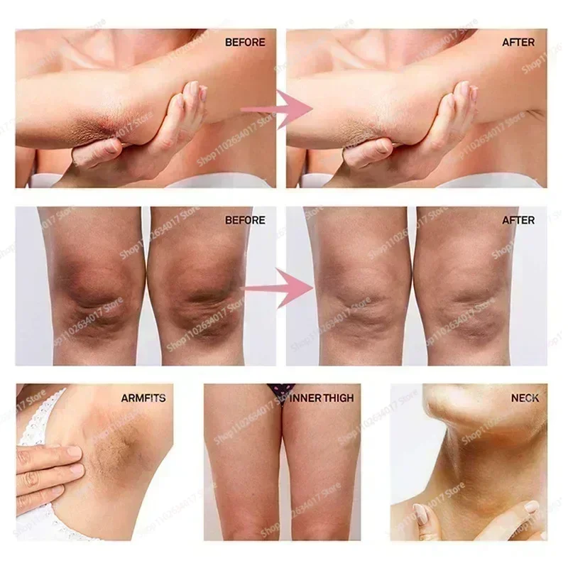 ร้อน ~ ครีม Private Parts Unde - Luxury Lifestyle Products บทวิจารณ์และราคา